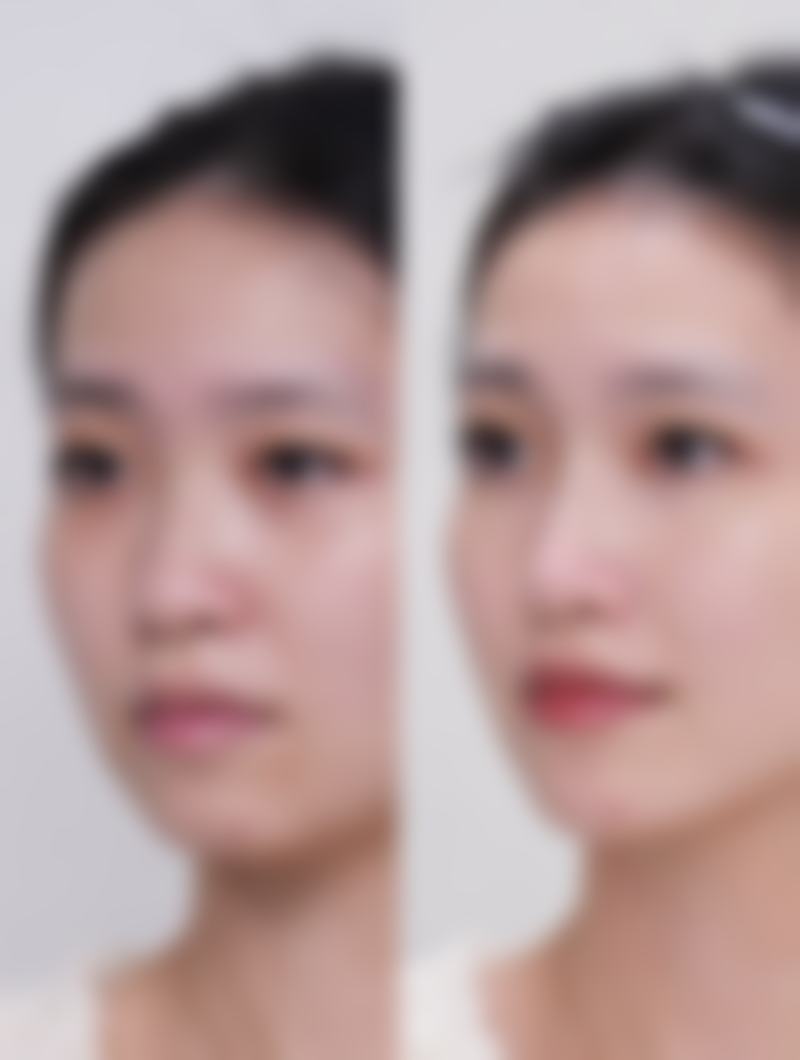 广东省人民医院整形外科科乘车路线