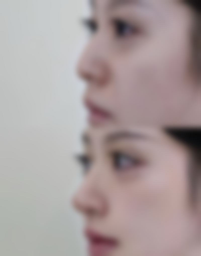 三、李月辉擅长项目及优势: