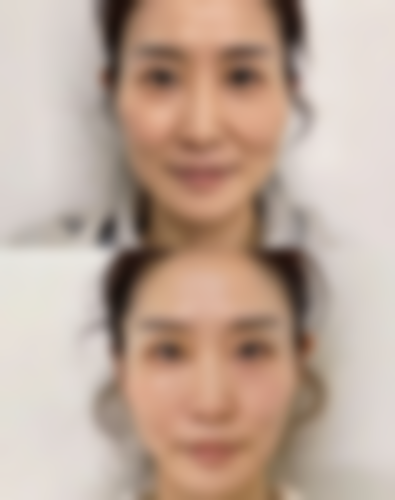 佛山梦露医学整形美容门诊部口碑评价