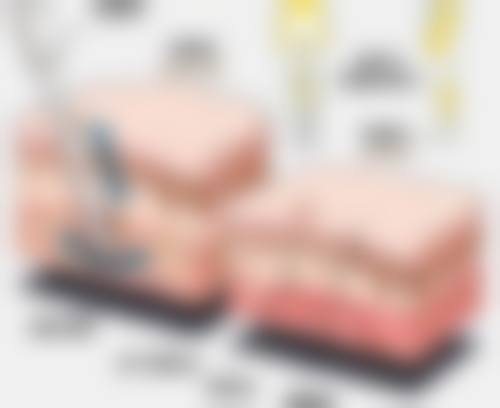预约优惠活动