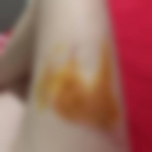 七、患者常见问题解答(精选 )