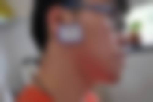 十四、邢台乔丽尔医疗美容诊所患者常见问答