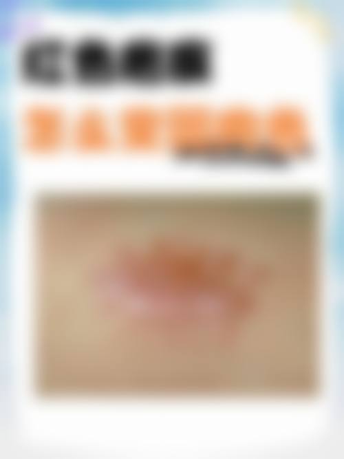 十、保定娇美肤美容美体医院整形科真人口碑实例评价一览