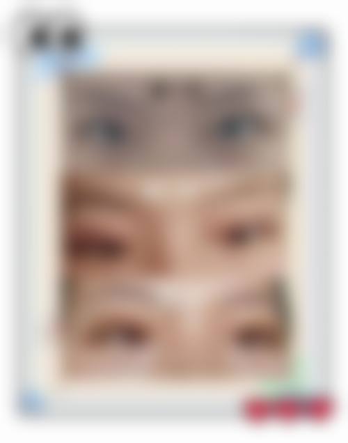 香港邊度割雙眼皮更好:價錢範圍(HKD)大公開!對比深圳邊個抵?
