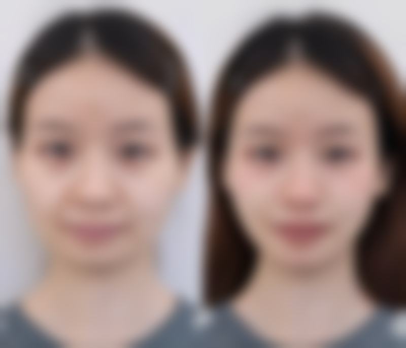 广东省人民医院整形外科科乘车路线