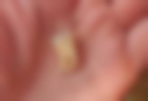 深圳佳美口腔箍牙实例:患者真實評價(好壞都講)