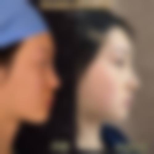 贵阳应超小李飞刀整形美容诊所医生团队经验稳定。