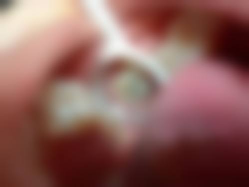 汕头黄其翼口腔诊所预约挂号方式。