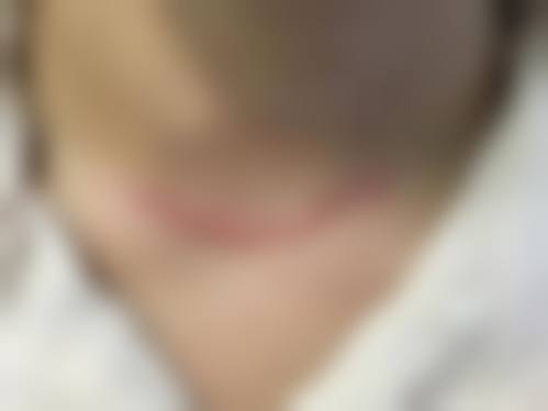六、西安未央容好臻美整形医院面部抗衰技术优势