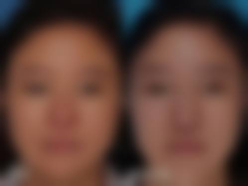 武汉顶吉整形医院医生团队经验稳定。
