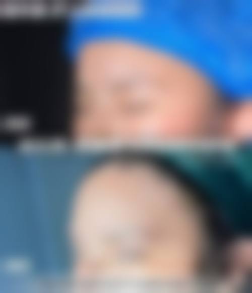 武汉顶吉整形医院擅长项目。
