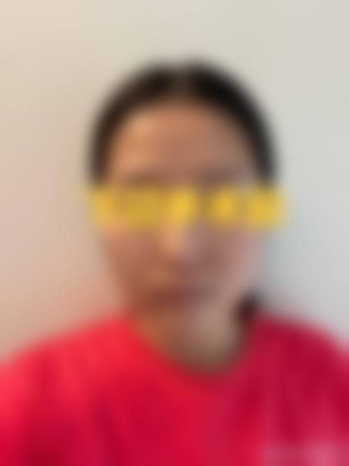大连鑫来美医疗美容整形医院擅长项目