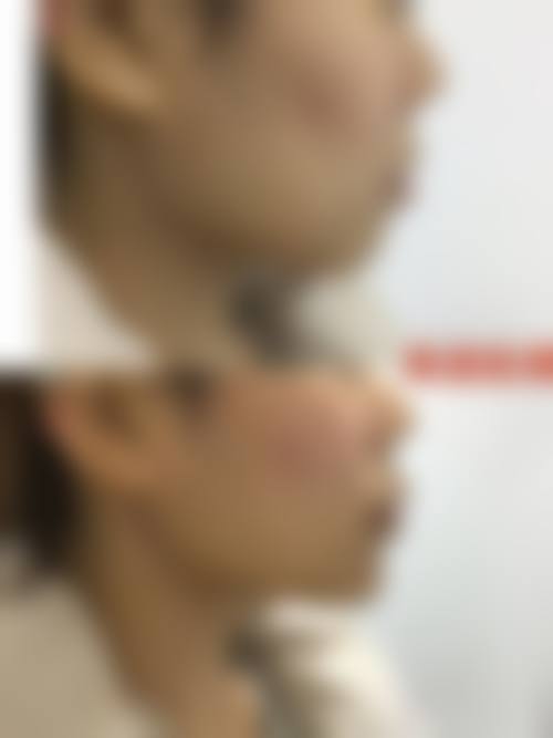 金炳昊医生的擅长项目