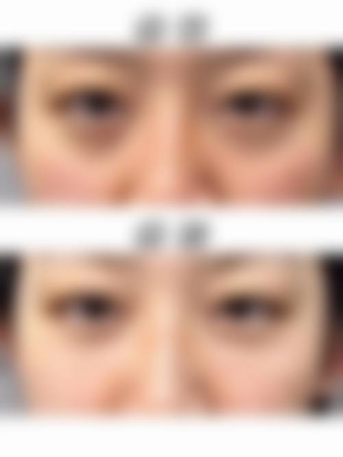 贵阳爱尔丽医疗美容门诊部治疗反馈与口碑评价。