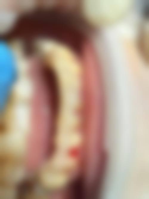 延安宝塔区艺嘉口腔诊所擅长项目。
