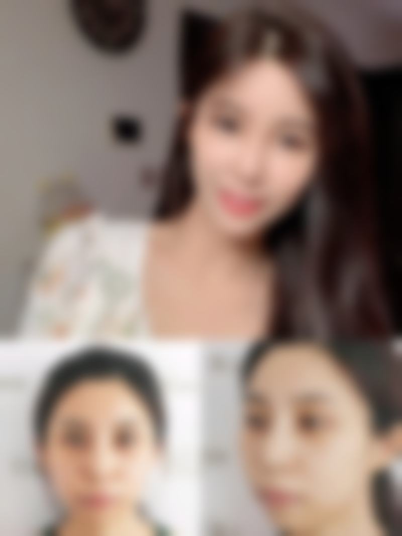 大连鑫来美医疗美容整形医院擅长项目