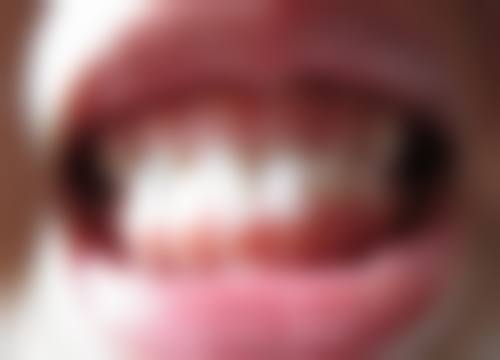 兴县康圣口腔门诊部擅长项目