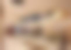 价格明细：北京米兰柏羽丽都医疗美容医院王佳手术成效如何的2026全新价格区间