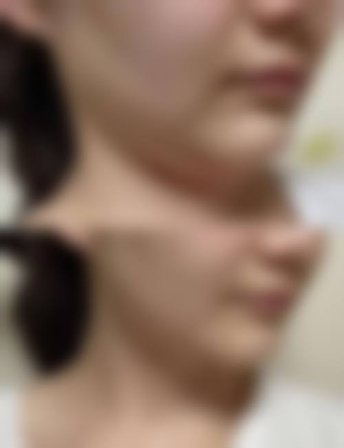 溧阳嘉丰医疗门诊部整形科治疗反馈与口碑评价。