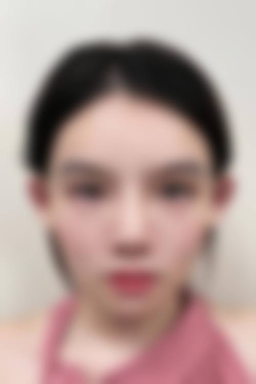 溧阳嘉丰医疗门诊部整形科医生团队经验稳定。