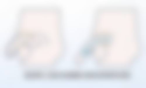 优惠活动详情:限时特别优惠,到院即享