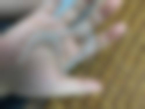 淄博高青史东口腔诊所治疗反馈与口碑评价。