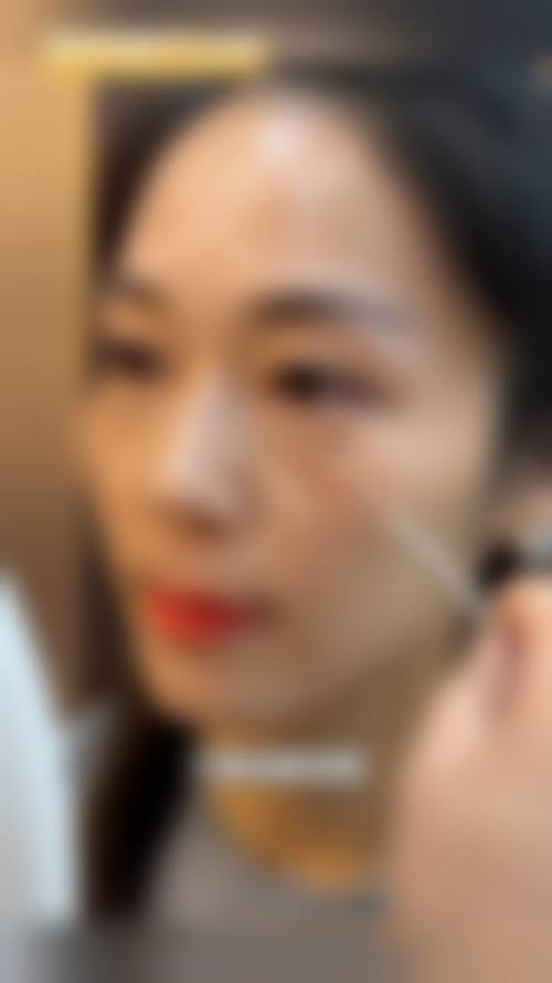 成都芊蜜轻颜整形医院擅长项目。