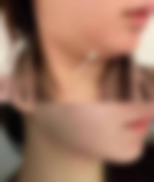 宁夏回族自治区人民医院整形美容科治疗反馈与口碑评价。
