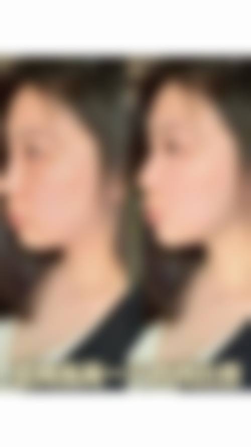 宁夏回族自治区人民医院整形美容科擅长项目。