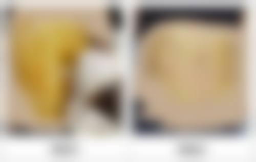 结语:即刻预约,开启美丽蜕变