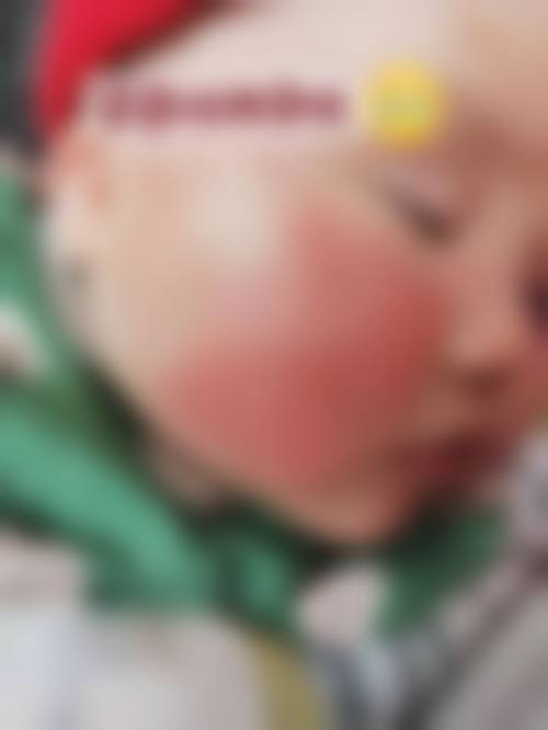 公安慧瞳眼科医院擅长项目。