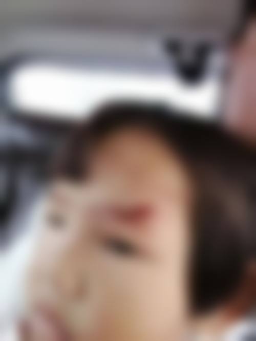 临床实例分享