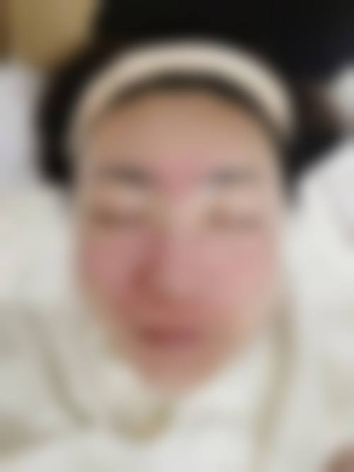 乌鲁木齐美容学会整形诊所治疗反馈与口碑评价。