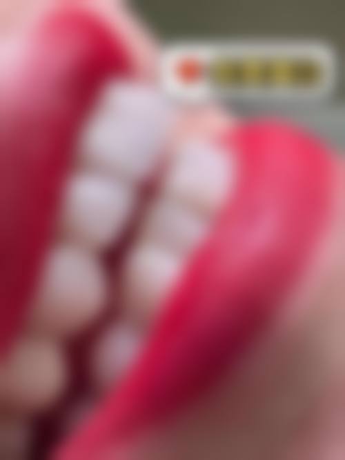 大连雅禾口腔诊所项目优势明显。