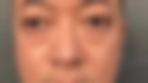 公安慧瞳眼科医院医生团队经验稳定。