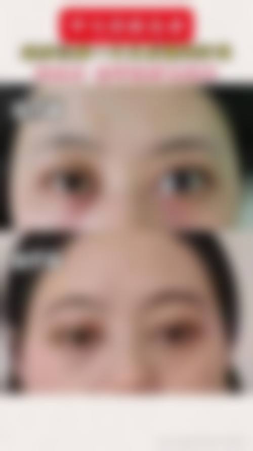 擅长项目详解