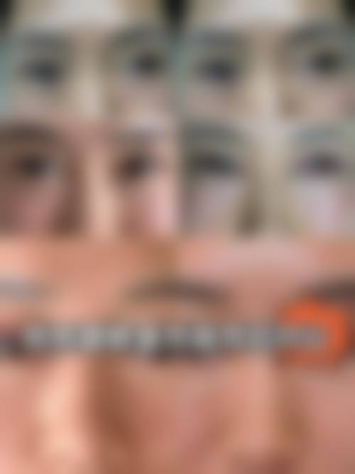 满洲里市人民医院眼科擅长项目。