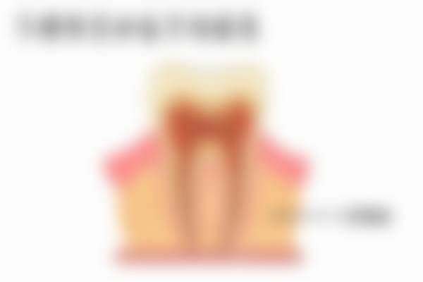 广州曙光美云口腔医院魏巍做过的真实反馈怎么样？5位患者亲述种牙正畸体验！种牙矫正靠谱吗？