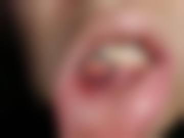 辽宁曙光整形外科医院(口腔科)治疗反馈与口碑评价。