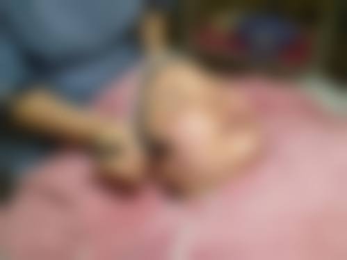 李秋彤医生技术优势剖析