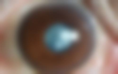 永州爱尔眼科医院的简介