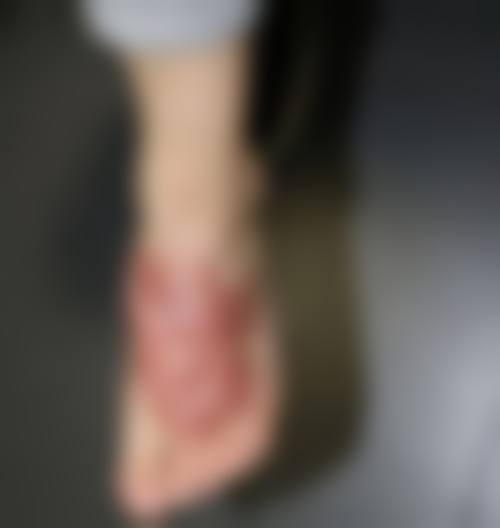 佛山顺德第一人民医院烧伤整形科24小时电话服务