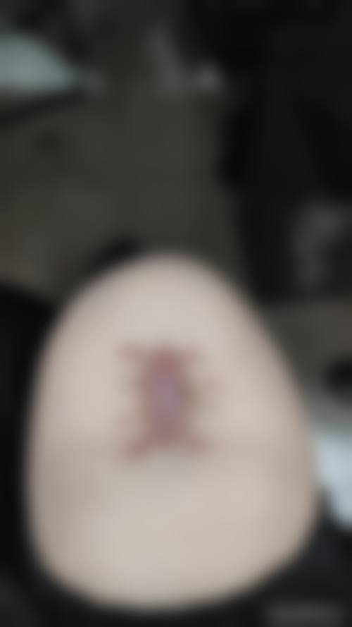 佛山顺德第一人民医院烧伤整形科地址及乘车路线