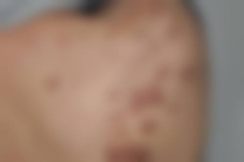 佛山顺德第一人民医院烧伤整形科及预约挂号指南