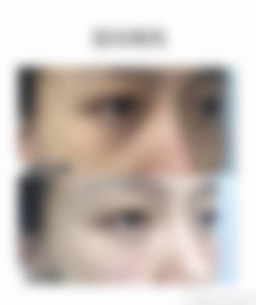 患者真实评价