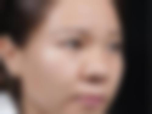 艾莱美医疗整形2026年价格收费表: