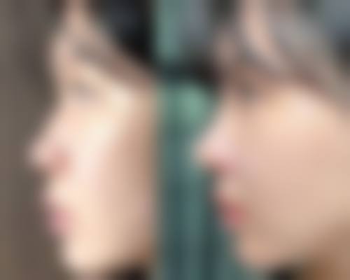 艾莱美医疗整形治疗反馈与口碑评价如何?