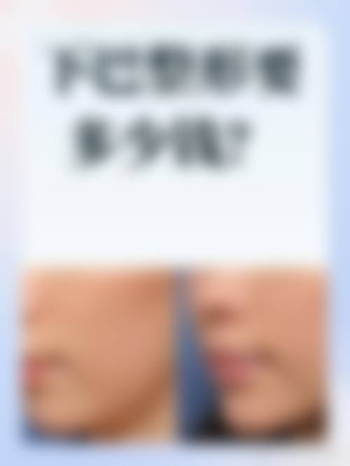 陈雪医生技术或实力