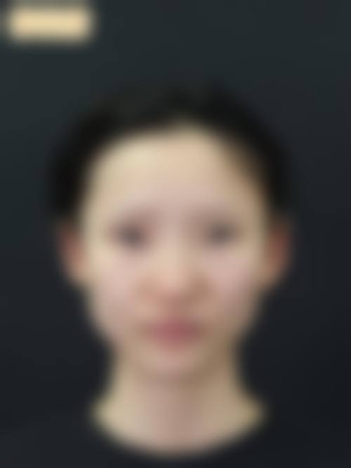 吉安艺美医疗美容门诊部治疗反馈与口碑评价。