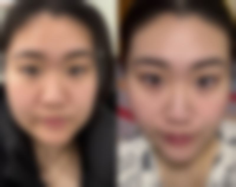 玄道瑧医生的技术实力